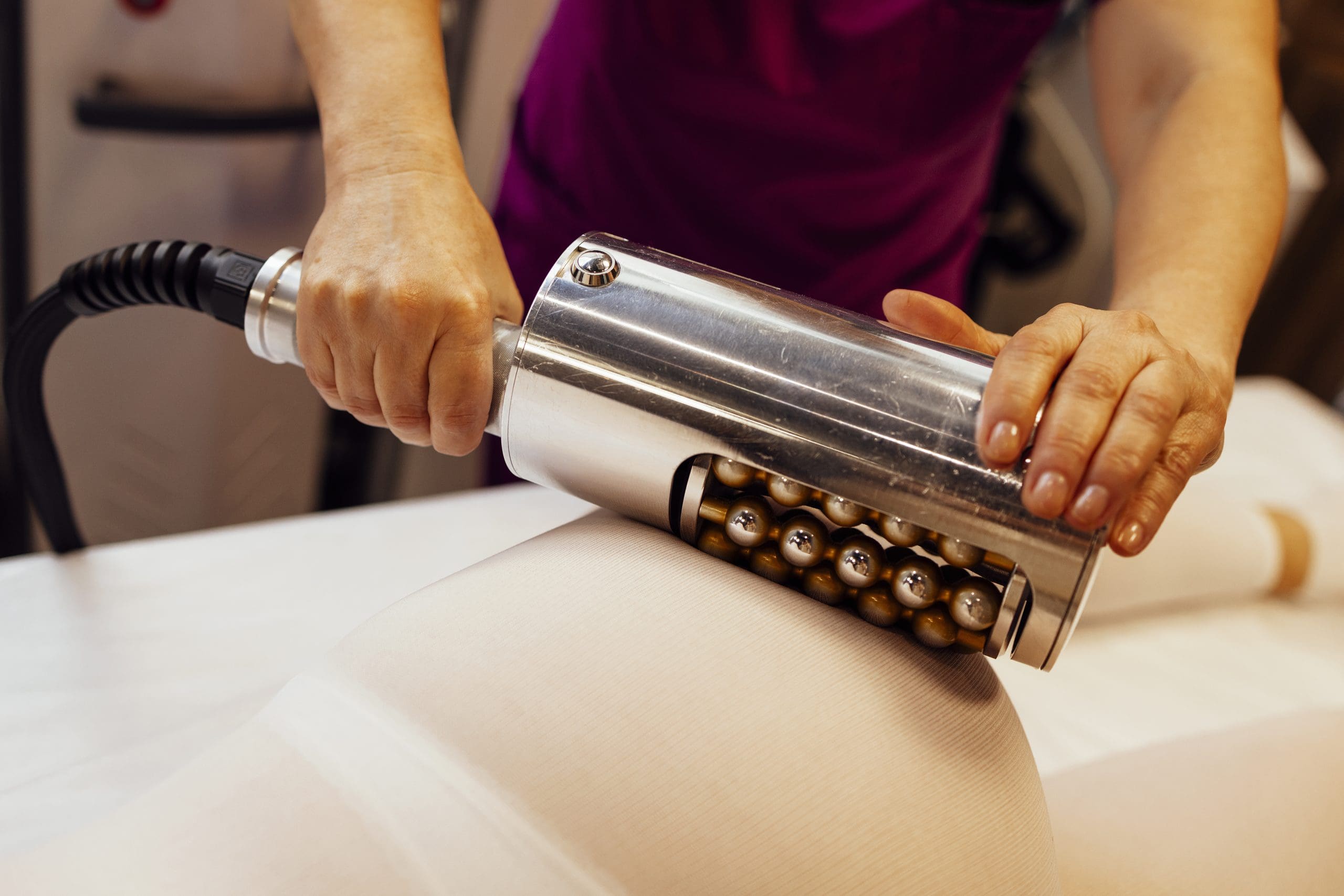 endospheres device being used on a patient to show that endospheres therapy isn't painful