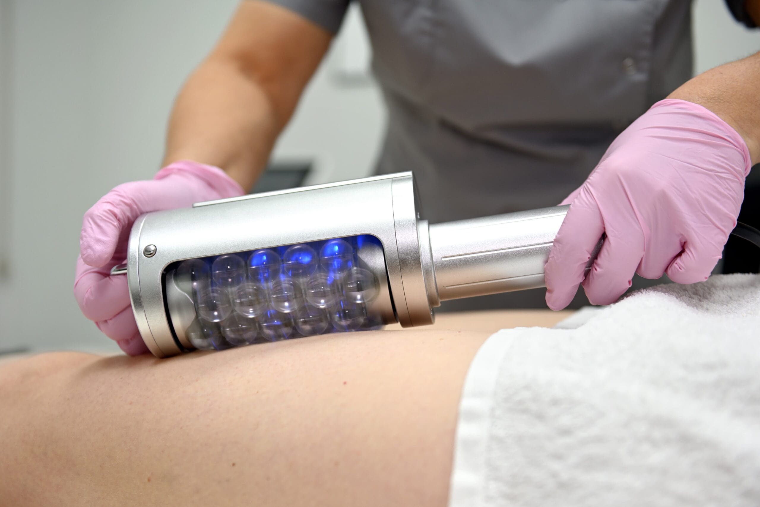 Endospheres device muscle recovery treatment close up